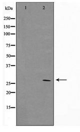 BCL2 / Bcl-2 Antibody - Western blot of MCF7 cell lysate using BCL-2 Antibody