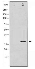 BCL2 / Bcl-2 Antibody - Western blot of BCL-2 expression in K562 whole cell lysates,The lane on the left is treated with the antigen-specific peptide.