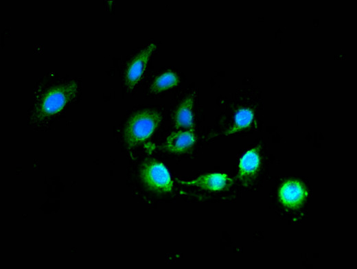 BCL2 / Bcl-2 Antibody - Immunofluorescent analysis of A549 cells using BCL2 Antibody at a dilution of 1:100 and Alexa Fluor 488-congugated AffiniPure Goat Anti-Rabbit IgG(H+L)