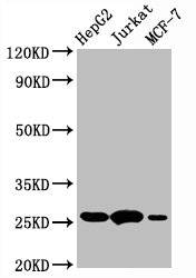 BCL2 / Bcl-2 Antibody - Western Blot Positive WB detected in:HepG2 whole cell lysate, Jurkat whole cell lysate, MCF-7 whole cell lysate All Lanes:BCL2 antibody at 1µg/ml Secondary Goat polyclonal to rabbit IgG at 1/50000 dilution Predicted band size: 26 KDa Observed band size: 26 KDa