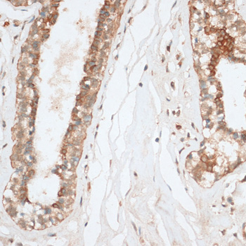 BCL2 / Bcl-2 Antibody - Immunohistochemistry of paraffin-embedded human breast using BCL2 antibody at dilution of 1:100 (40x lens).