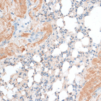 BCL2 / Bcl-2 Antibody - Immunohistochemistry of paraffin-embedded mouse lung using BCL2 antibody at dilution of 1:100 (40x lens).