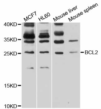 BCL2 / Bcl-2 Antibody - Western blot analysis of extracts of various cell lines, using BCL2 antibody at 1:1000 dilution. The secondary antibody used was an HRP Goat Anti-Rabbit IgG (H+L) at 1:10000 dilution. Lysates were loaded 25ug per lane and 3% nonfat dry milk in TBST was used for blocking. An ECL Kit was used for detection and the exposure time was 10s.