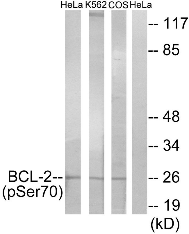 BCL2 / Bcl-2 Antibody - Western blot analysis of lysates from HeLa cells treated with LPS (40nM, 30mins), K562 cells treated with calyculin A (50ng/ml, 30mins) and COS-7 cells treated with H2O2 (1ng/ml, 15mins), using BCL-2 (Phospho-Ser70) Antibody. The lane on the right is blocked with the phospho peptide.