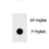 BCL2 / Bcl-2 Antibody - Dot blot of Phospho-bcl-2-S70 Antibody Phospho-specific antibody on nitrocellulose membrane. 50ng of Phospho-peptide or Non Phospho-peptide per dot were adsorbed. Antibody working concentrations are 0.6ug per ml.