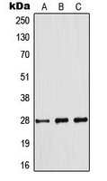 BCL2 / Bcl-2 Antibody - Western blot analysis of BCL2 (pS70) expression in Jurkat (A); THP1 (B); A2780 (C) whole cell lysates.