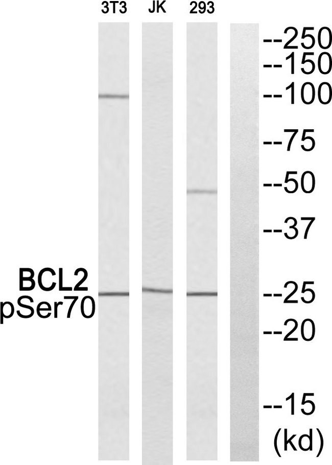 BCL2 / Bcl-2 Antibody - Western blot of extracts from 293 cells. Jurkat cells and NIH/3T3 cells all treated with Paclitaxel, using BCL2 (Phospho-Ser70) antibody.