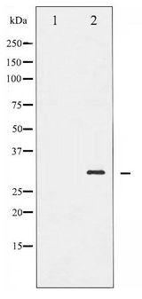 BCL2 / Bcl-2 Antibody - Western blot of BCL-2 phosphorylation expression in LPS treated HeLa whole cell lysates,The lane on the left is treated with the antigen-specific peptide.