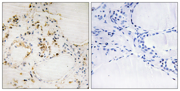 BCL2 / Bcl-2 Antibody - Immunohistochemistry analysis of paraffin-embedded human thyroid gland, using BCL-2 (Phospho-Ser87) Antibody. The picture on the right is blocked with the phospho peptide.