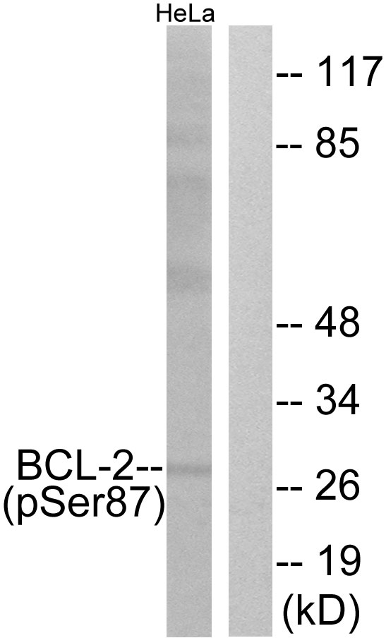 BCL2 / Bcl-2 Antibody - Western blot analysis of lysates from HeLa cells treated with nocodazole 1ug/ml 18h, using BCL-2 (Phospho-Ser87) Antibody. The lane on the right is blocked with the phospho peptide.