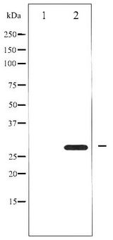 BCL2 / Bcl-2 Antibody - Western blot of BCL-2 phosphorylation expression in nocodazole treated HeLa whole cell lysates,The lane on the left is treated with the antigen-specific peptide.