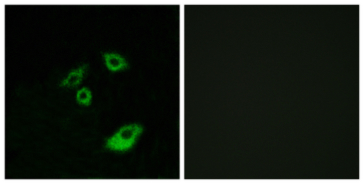 BCL2 / Bcl-2 Antibody - Immunofluorescence analysis of A549 cells, using BCL-2 (Phospho-Thr56) Antibody. The picture on the right is blocked with the phospho peptide.