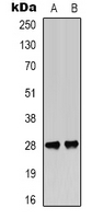 BCL2 / Bcl-2 Antibody - Western blot analysis of BCL2 (pT56) expression in Jurkat (A); rat muscle (B) whole cell lysates.