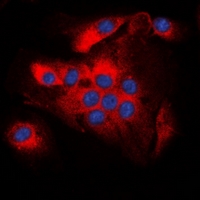 BCL2 / Bcl-2 Antibody - Immunofluorescent analysis of BCL2 (pT56) staining in A549 cells. Formalin-fixed cells were permeabilized with 0.1% Triton X-100 in TBS for 5-10 minutes and blocked with 3% BSA-PBS for 30 minutes at room temperature. Cells were probed with the primary antibody in 3% BSA-PBS and incubated overnight at 4 deg C in a humidified chamber. Cells were washed with PBST and incubated with a DyLight 594-conjugated secondary antibody (red) in PBS at room temperature in the dark. DAPI was used to stain the cell nuclei (blue).