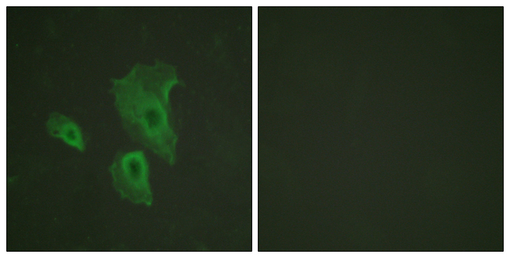 BCL2 / Bcl-2 Antibody - Immunofluorescence analysis of HeLa cells, using BCL-2 (Phospho-Thr69) Antibody. The picture on the right is blocked with the phospho peptide.