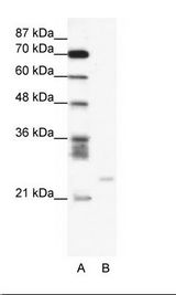 BCL2A1 Antibody - A: Marker, B: Jurkat Cell Lysate.  This image was taken for the unconjugated form of this product. Other forms have not been tested.