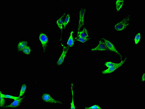 BCL2A1 Antibody - Immunofluorescent analysis of Hela cells using BCL2A1 Antibody at a dilution of 1:100 and Alexa Fluor 488-congugated AffiniPure Goat Anti-Rabbit IgG(H+L)
