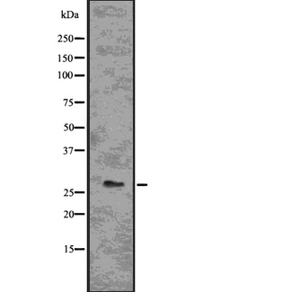 BCL2A1 Antibody - Western blot analysis of BCL-2A1 using Jurkat whole lysates.