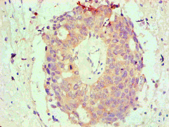 BCL2L1 / BCL-XL Antibody - Immunohistochemical of paraffin-embedded Human endometrium tissue using BCL2L1 Monoclonal Antibody at dilution of 1:200