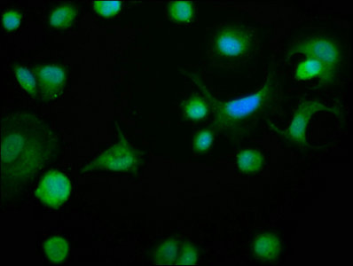 BCL2L1 / BCL-XL Antibody - Immunofluorescence staining of MCF-7 cells with BCL2L1 Antibody at 1:133, counter-stained with DAPI. The cells were fixed in 4% formaldehyde, permeabilized using 0.2% Triton X-100 and blocked in 10% normal Goat Serum. The cells were then incubated with the antibody overnight at 4°C. The secondary antibody was Alexa Fluor 488-congugated AffiniPure Goat Anti-Rabbit IgG(H+L).