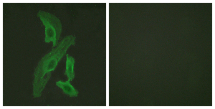 BCL2L1 / BCL-XL Antibody - Immunofluorescence analysis of HeLa cells, using BCL-XL Antibody. The picture on the right is blocked with the synthesized peptide.