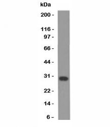 BCL2L1 / BCL-XL Antibody - Western blot analysis of Jurkat cell lysate using Bcl-X antibody (BX006 + 2H12).  This image was taken for the unmodified form of this product. Other forms have not been tested.