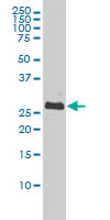 BCL2L1 / BCL-XL Antibody - BCL2L1 monoclonal antibody (M01), clone 3E2-2A5 Western Blot analysis of BCL2L1 expression in A-431.