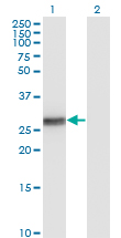 BCL2L1 / BCL-XL Antibody - Western Blot analysis of BCL2L1 expression in transfected 293T cell line by BCL2L1 monoclonal antibody (M01), clone 3E2-2A5.Lane 1: BCL2L1 transfected lysate (Predicted MW: 26 KDa).Lane 2: Non-transfected lysate.