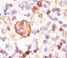 BCL2L1 / BCL-XL Antibody - Bcl-X antibody immunohistochemistry.  This image was taken for the unmodified form of this product. Other forms have not been tested.