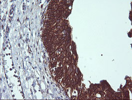 BCL2L1 / BCL-XL Antibody - IHC of paraffin-embedded Human bladder tissue using anti-BCL2L1 mouse monoclonal antibody.