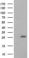 BCL2L1 / BCL-XL Antibody - HEK293T cells were transfected with the pCMV6-ENTRY control (Left lane) or pCMV6-ENTRY BCL2L1 (Right lane) cDNA for 48 hrs and lysed. Equivalent amounts of cell lysates (5 ug per lane) were separated by SDS-PAGE and immunoblotted with anti-BCL2L1.