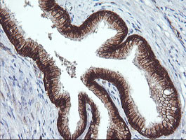 BCL2L1 / BCL-XL Antibody - IHC of paraffin-embedded Human prostate tissue using anti-BCL2L1 mouse monoclonal antibody.