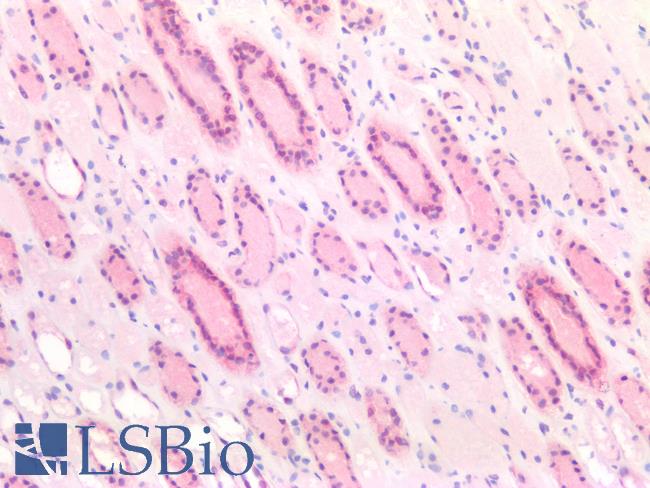 BCL2L1 / BCL-XL Antibody - Human Kidney: Formalin-Fixed, Paraffin-Embedded (FFPE)