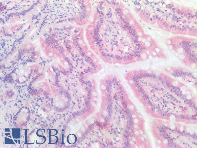 BCL2L1 / BCL-XL Antibody - Human Small Intestine: Formalin-Fixed, Paraffin-Embedded (FFPE)