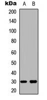 BCL2L1 / BCL-XL Antibody - Western blot analysis of BCLX expression in Jurkat (A); HeLa (B) whole cell lysates.