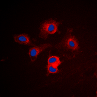 BCL2L1 / BCL-XL Antibody - Immunofluorescent analysis of BCLX staining in Jurkat cells. Formalin-fixed cells were permeabilized with 0.1% Triton X-100 in TBS for 5-10 minutes and blocked with 3% BSA-PBS for 30 minutes at room temperature. Cells were probed with the primary antibody in 3% BSA-PBS and incubated overnight at 4 deg C in a humidified chamber. Cells were washed with PBST and incubated with a DyLight 594-conjugated secondary antibody (red) in PBS at room temperature in the dark. DAPI was used to stain the cell nuclei (blue).