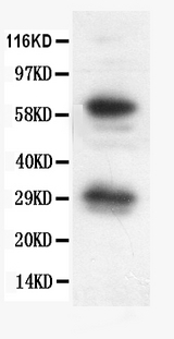 BCL2L1 / BCL-XL Antibody - Western blot - Anti-Bcl-X Picoband Antibody