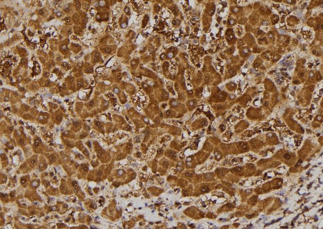 BCL2L1 / BCL-XL Antibody - 1:100 staining human liver tissue by IHC-P. The sample was formaldehyde fixed and a heat mediated antigen retrieval step in citrate buffer was performed. The sample was then blocked and incubated with the antibody for 1.5 hours at 22°C. An HRP conjugated goat anti-rabbit antibody was used as the secondary.