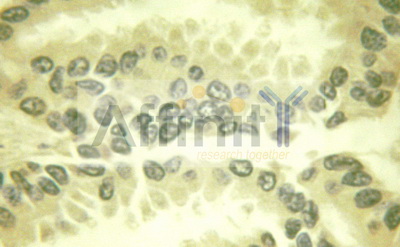 BCL2L1 / BCL-XL Antibody - 1/100 staining human colon  tissue by IHC-P. The sample was formaldehyde fixed and a heat mediated antigen retrieval step in citrate buffer was performed. The sample was then blocked and incubated with the antibody for 1.5 hours at 22°C. An HRP conjugated goat anti-rabbit antibody was used as the secondary antibody.