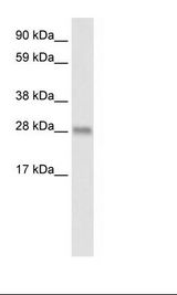 BCL2L1 / BCL-XL Antibody - Fetal Thymus Lysate.  This image was taken for the unconjugated form of this product. Other forms have not been tested.