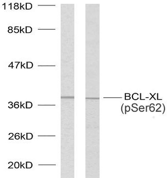 BCL2L1 / BCL-XL Antibody - Western blot analysis of lysates from 293 cells treated with UV and MDA-MB-435 cells treated with UV, using BCL-XL (Phospho-Ser62) Antibody.