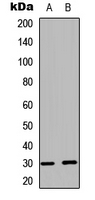 BCL2L1 / BCL-XL Antibody - Western blot analysis of BCLX (pS62) expression in HEK293T UV-treated (A); rat muscle (B) whole cell lysates.