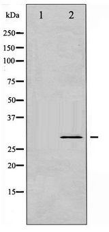 BCL2L1 / BCL-XL Antibody - Western blot of BCL-XL phosphorylation expression in UV treated 293 whole cell lysates,The lane on the left is treated with the antigen-specific peptide.