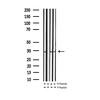 BCL2L1 / BCL-XL Antibody - Western blot analysis of Phospho-BCL-XL (Ser62) expression in various lysates