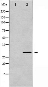 BCL2L1 / BCL-XL Antibody - Western blot analysis of BCL-XL phosphorylation expression in UV treated 293 whole cells lysates. The lane on the left is treated with the antigen-specific peptide.