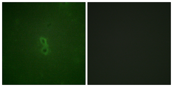 BCL2L1 / BCL-XL Antibody - Immunofluorescence analysis of NIH/3T3 cells, using BCL-XL (Phospho-Thr47) Antibody. The picture on the right is blocked with the phospho peptide.