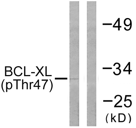 BCL2L1 / BCL-XL Antibody - Western blot analysis of lysates from 293 cells treated with UV 30', using BCL-XL (Phospho-Thr47) Antibody. The lane on the right is blocked with the phospho peptide.