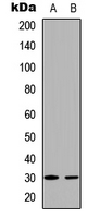 BCL2L1 / BCL-XL Antibody - Western blot analysis of BCLX (pT47) expression in MDAMB231 (A); HeLa (B) whole cell lysates.