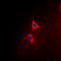 BCL2L1 / BCL-XL Antibody - Immunofluorescent analysis of BCLX (pT47) staining in HeLa cells. Formalin-fixed cells were permeabilized with 0.1% Triton X-100 in TBS for 5-10 minutes and blocked with 3% BSA-PBS for 30 minutes at room temperature. Cells were probed with the primary antibody in 3% BSA-PBS and incubated overnight at 4 deg C in a humidified chamber. Cells were washed with PBST and incubated with a DyLight 594-conjugated secondary antibody (red) in PBS at room temperature in the dark. DAPI was used to stain the cell nuclei (blue).