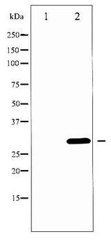 BCL2L1 / BCL-XL Antibody - Western blot of BCL-XL phosphorylation expression in UV treated 293 whole cell lysates,The lane on the left is treated with the antigen-specific peptide.